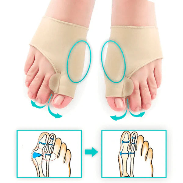 Corrector ortopédico de juanete x 2 unidades