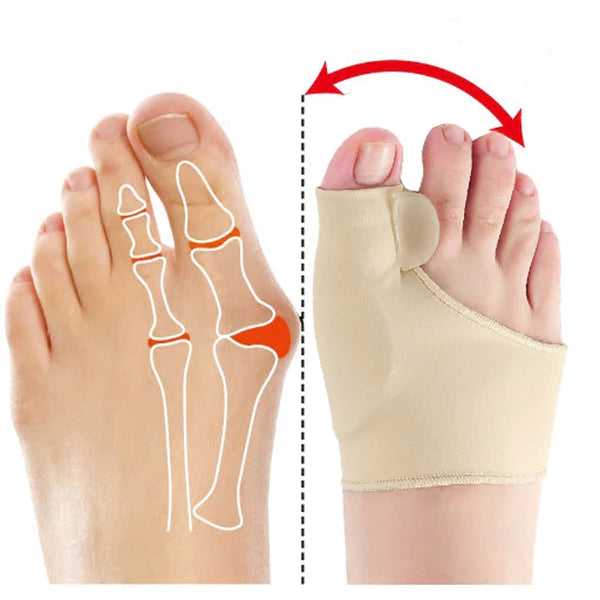 Corrector ortopédico de juanete x 2 unidades